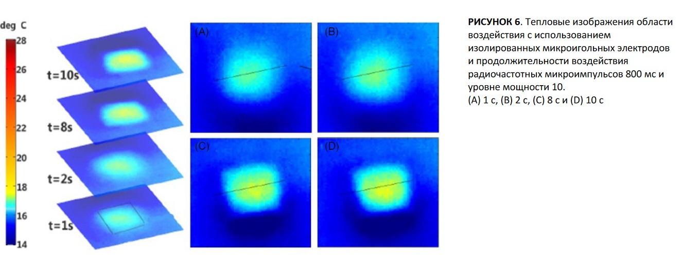 Рисунок 6. Тепловые изображения области воздействия с использованием изолированных микроигольных электродов и продолжительности воздействия радиочастотных микроимпульсов 800 мс и уровне мощности 10. (A) 1 с, (B) 2 с, (C) 8 с и (D) 10 с.